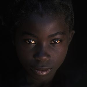 Malawi - Young orphan girl, Kuya